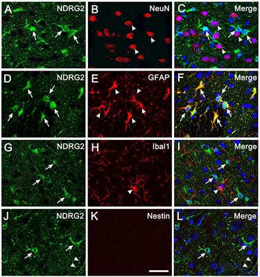 NDRG2 regulates the formation of reactive astrocyte-derived progenitor cells via Notch signaling pathway after brain traumatic injury in rats